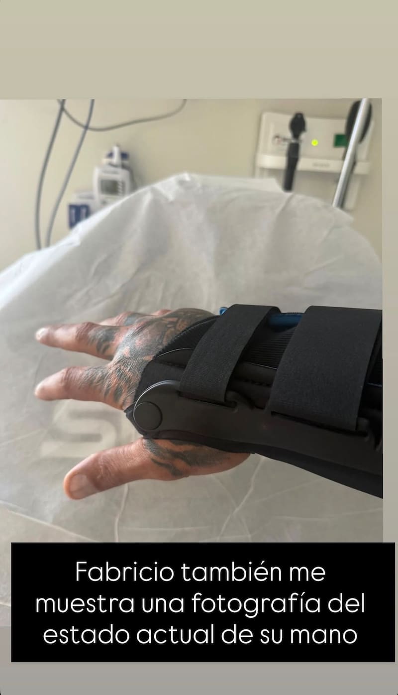 La prueba de su mano lesionada. Foto: Cecilia Gutiérrez