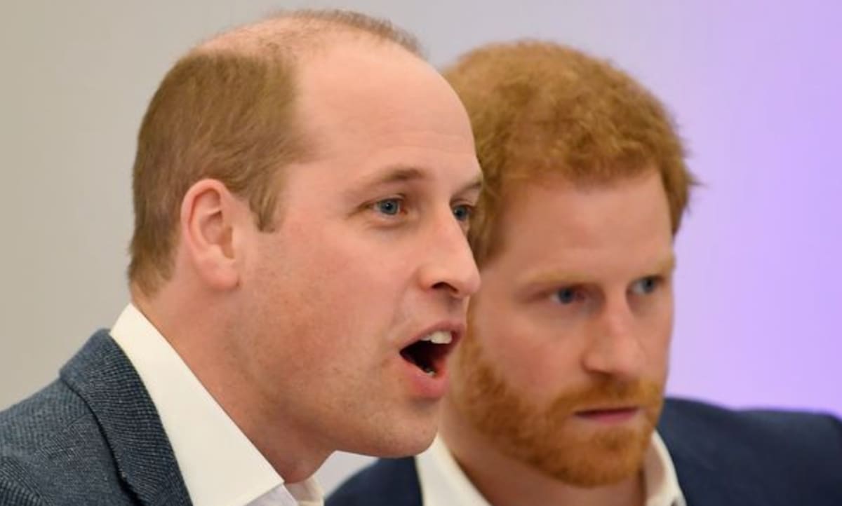 Príncipe Harry sufre alopecia como su hermano el príncipe William.