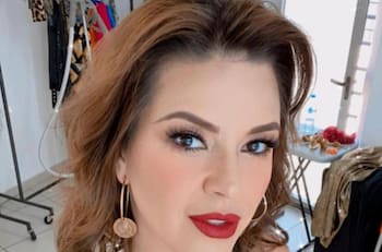 Así luce Alicia Machado tras someterse a un arreglito estético en la cara