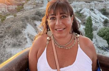 “Me tiene chata”: Helhue Sukni mostró cómo están sus ojos tras abrupta intervención médica