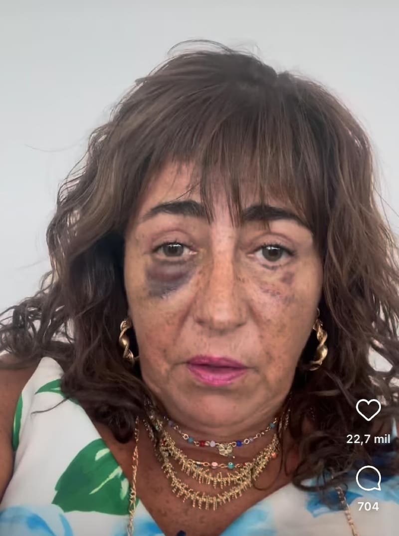 Helhue Sukni arremetió contra quienes se burlan de la muerte de Sebastián Piñera.