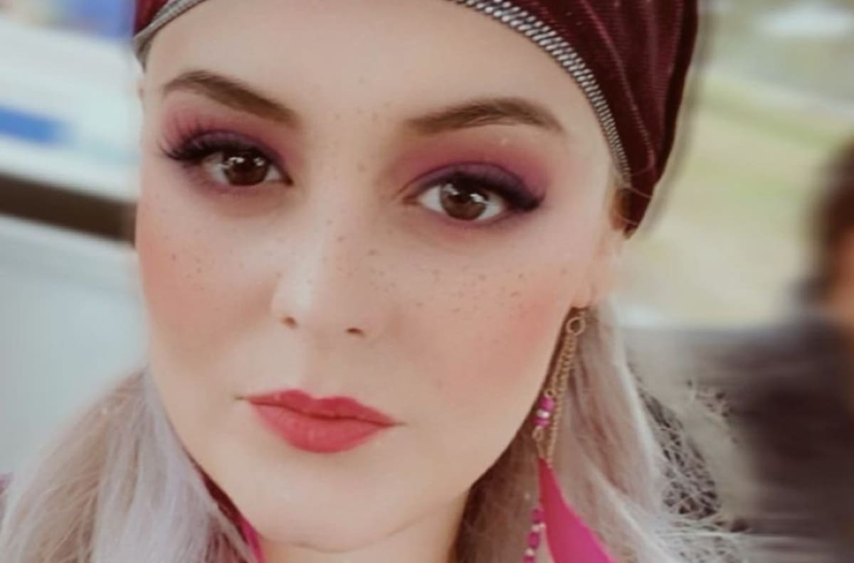 Allisson Lozz desmiente que Altair Jarabo intentara buscarla tras enterarse que podría quedar ciega