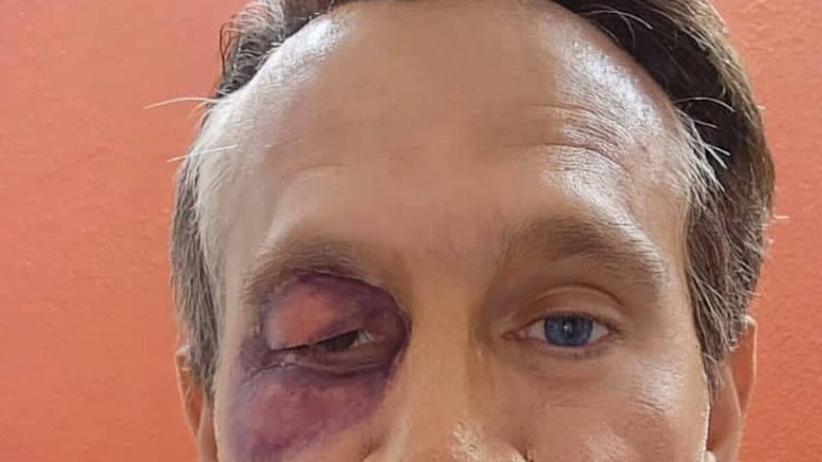 Arath de la Torre parodia a un golpeado Alfredo Adame