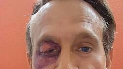 Arath de la Torre parodia a un golpeado Alfredo Adame