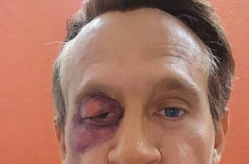 Arath de la Torre parodia a un golpeado Alfredo Adame