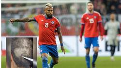 ¡Impactante! Se hizo corte de pelo con la cara de Arturo Vidal