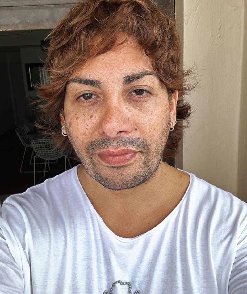 Botota Fox declaró que se le caía el pelo. Créditos: Instagram