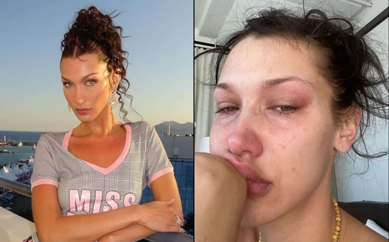 Bella Hadid La modelo de 25 años abrió su corazón y habló por primera vez de los problemas de salud mental que padece - Créditos: Instagram: @bellahadid