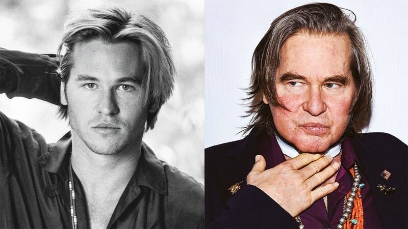 Val Kilmer El actor revela el difícil proceso de su lucha contra el cáncer de garganta - Créditos: Foto de archivo