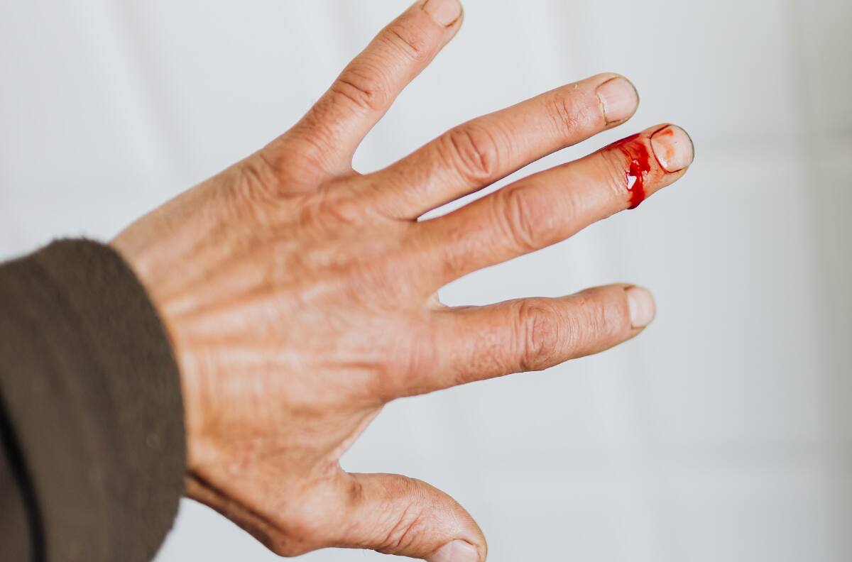 Interpretación de sueños: ¿Qué significa soñar con sangre?