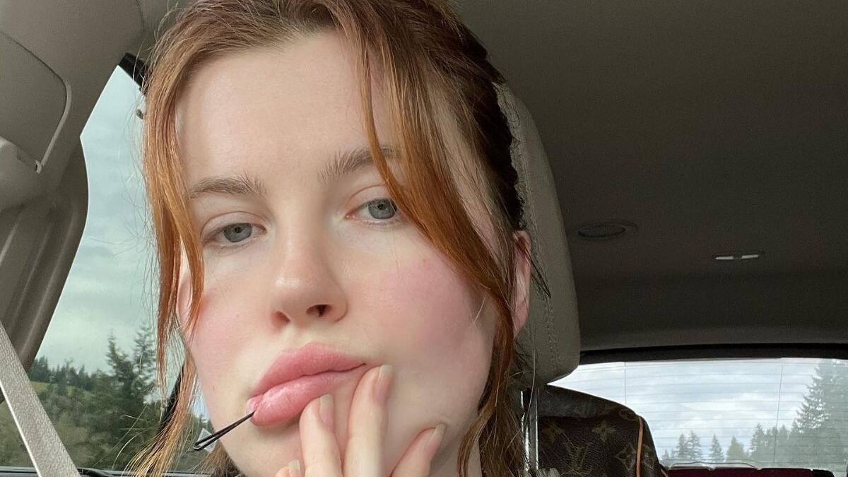 Hija mayor de Alec Baldwin se somete a cirugía plástica a sus 26 años por importante razón