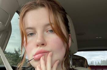 Hija mayor de Alec Baldwin se somete a cirugía plástica a sus 26 años por importante razón