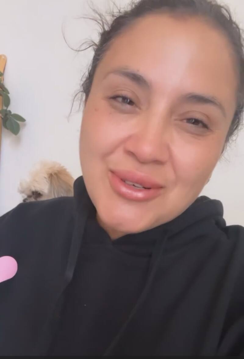 Pamela Leiva dijo que su madre mostró señales de mejoría tras sufrir un shock anafiláctico.