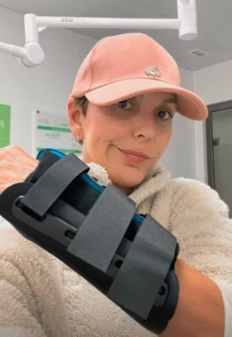 La animadora sufrió accidente en aeropuerto.