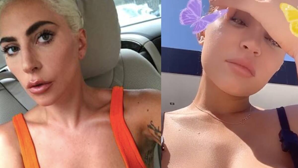 Kylie Jenner, Lady Gaga y más famosas que presumen sus estrías con orgullo