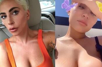 Kylie Jenner, Lady Gaga y más famosas que presumen sus estrías con orgullo