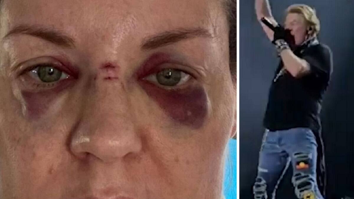 Axl Rose dejará de tirar su micrófono al público tras denuncia de mujer que salió lastimada