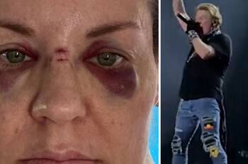 Axl Rose dejará de tirar su micrófono al público tras denuncia de mujer que salió lastimada