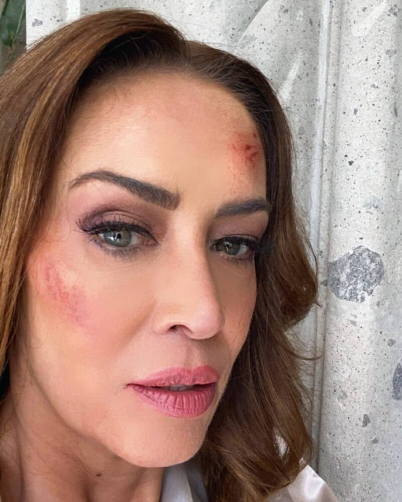 Regresa a los melodramas - Créditos: Instagram de @anettemicheltv