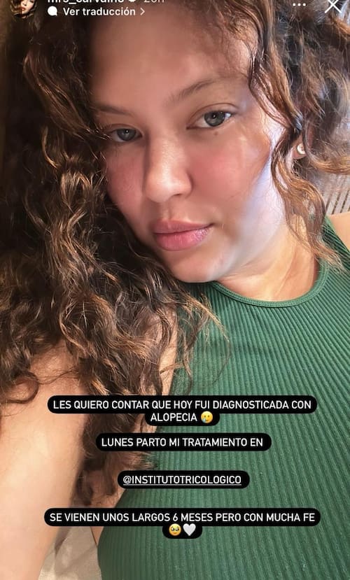 Michelle Carvalho reveló que sufre una delicada condición.