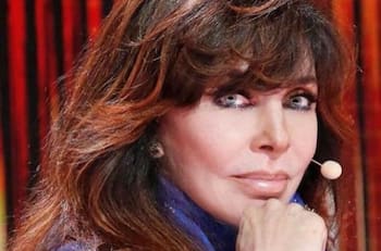 La vez que Verónica Castro sufrió un terrible accidente con un elefante y le dejó varias lesiones