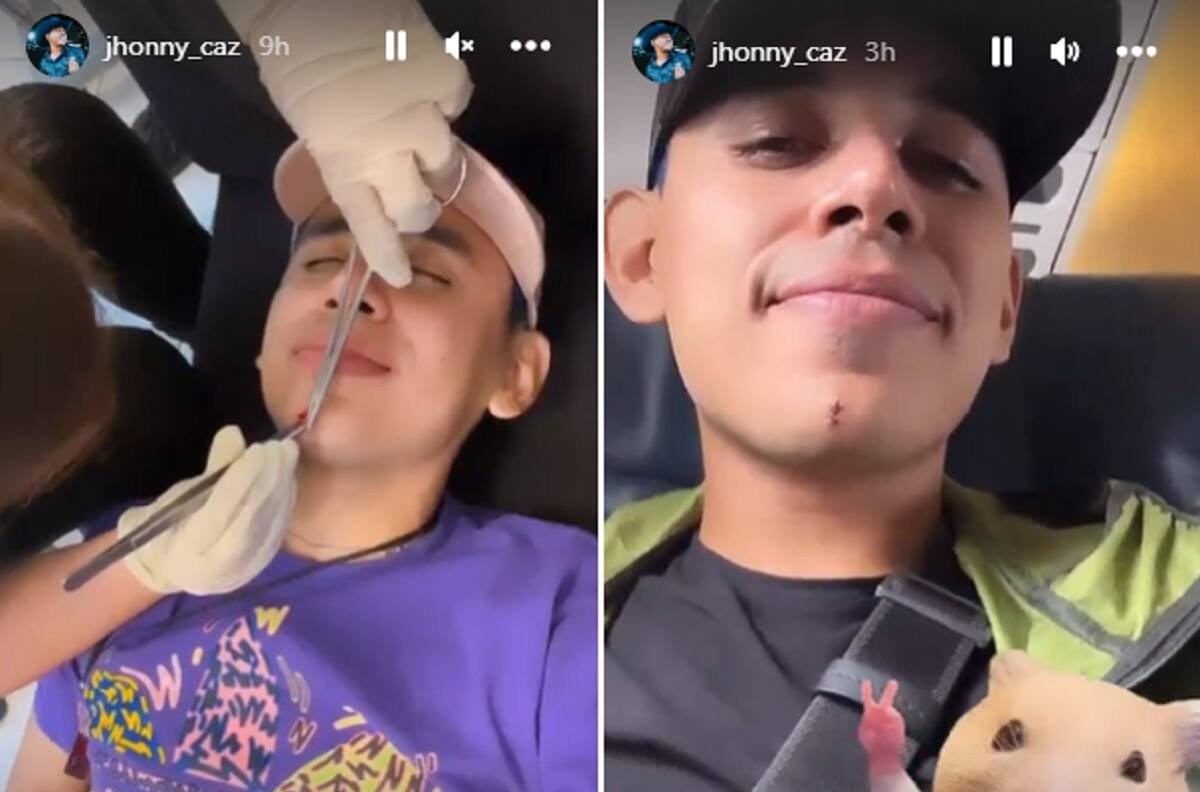 El accidentado show de Grupo Firme: A Eduin Caz le tembló el piso y Jhonny Caz recibió sutura