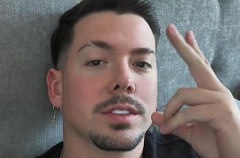 “Habría utilizado un objeto contundente”: Filtran detalles y fotos de la supuesta golpiza de Nano Calderón a influencer