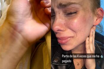 Cass Zamorano alarma a sus seguidores tras ser detenida por agresiones