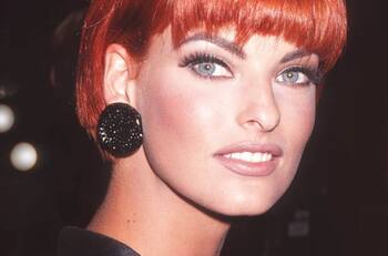 Linda Evangelista se desfigura el rostro tras someterse a procedimiento estético