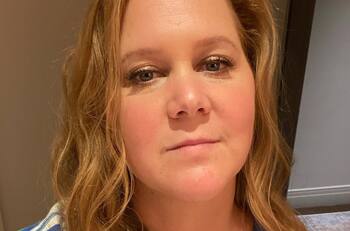 "Me siento fantástica": Amy Schumer revela que se sometió a una liposucción