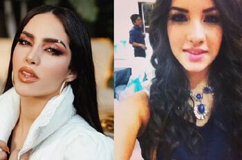 El antes y después de Kimberly Loaiza