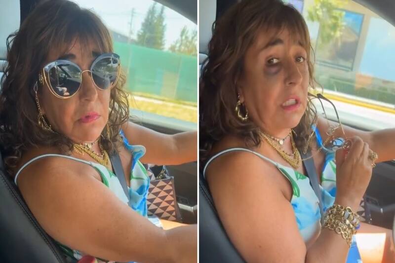 sigue adolorida tras su cirugía.