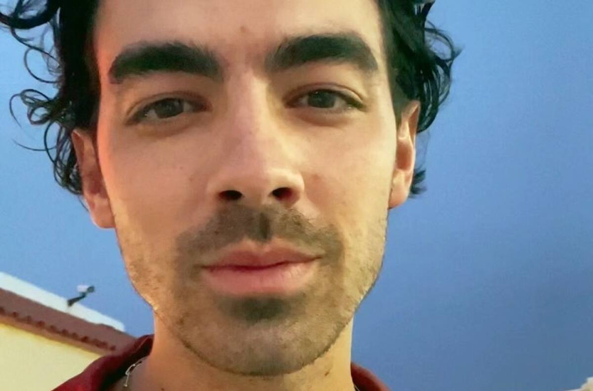 Joe Jonas se sincera y habla sobre el tratamiento estético al que se sometió en el rostro