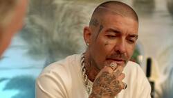 El increíble antes y después de DJ Méndez tras realizarse procedimiento estético