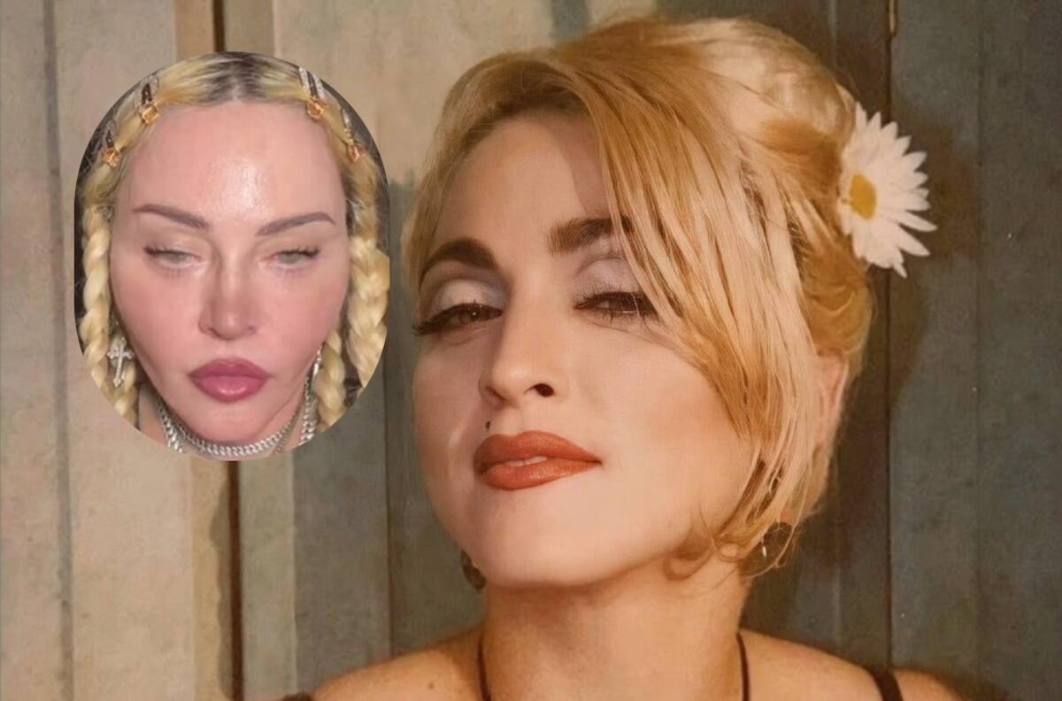 “Da miedo”: Madonna preocupa a sus seguidores al reaparecer con “nueva cara”