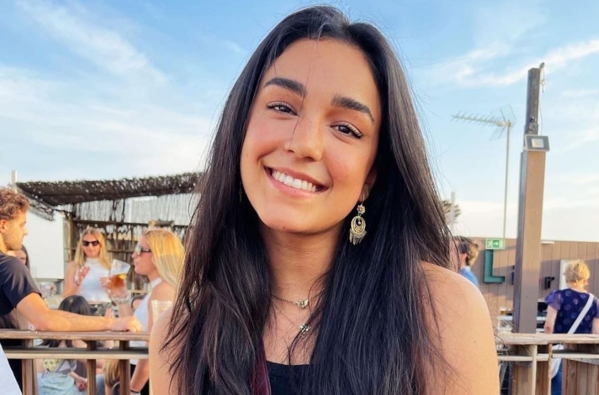 Ale Capetillo se quema el rostro por descuido mientras cocinaba