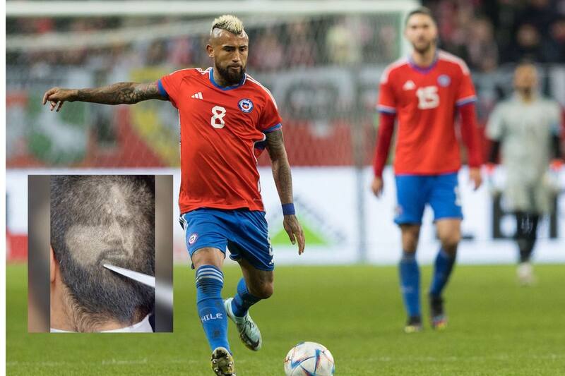 Arturo Vidal Arturo Vidal desata pasiones y un hincha lo demostró con un look inspirada en el "King". - Créditos: Agencia Aton - En Cancha