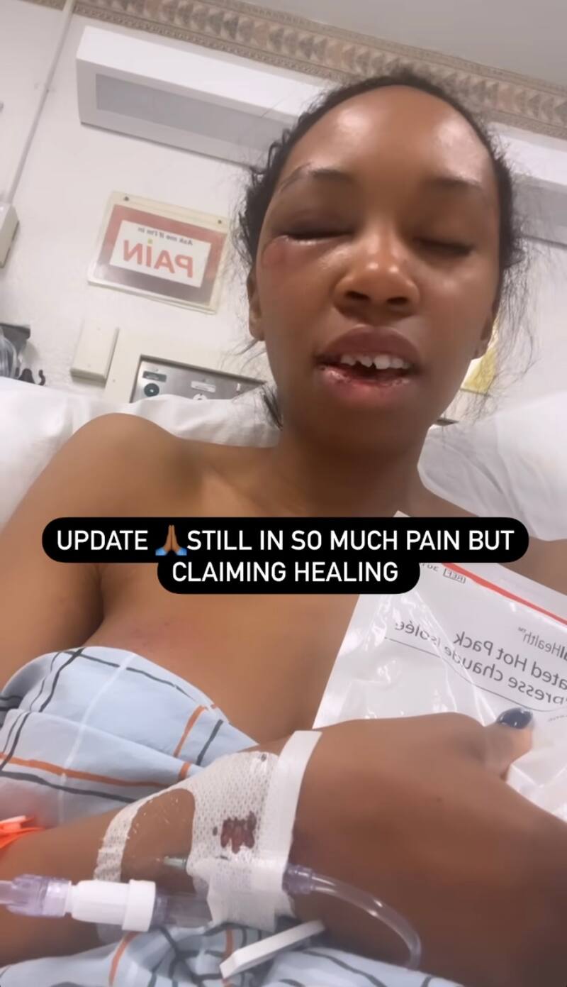 Carrie Bernans se encuentra en recuperación tras el accidente. Foto: Instagram.