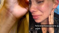 Cass Zamorano alarma a sus seguidores tras ser detenida por agresiones