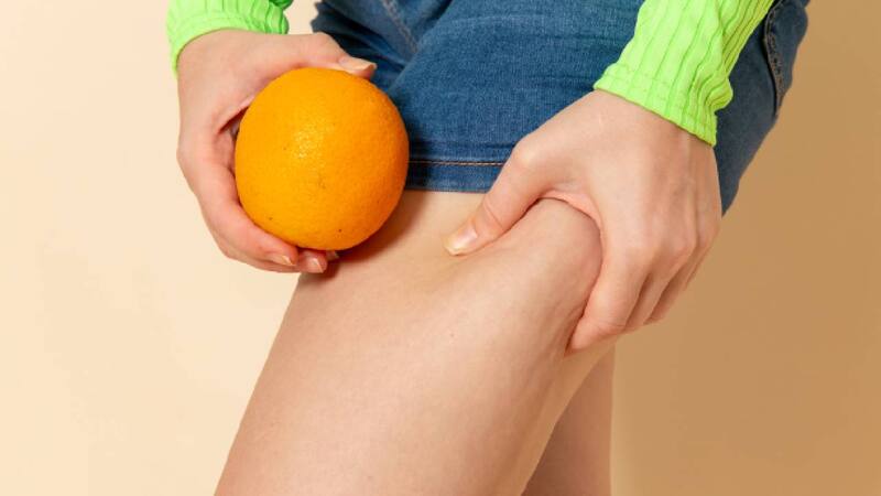 Termina con la piel de naranja con este remedio natural (Foto: Freepik)