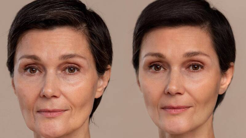 Con estos consejos podrás revertir los signos de la edad.