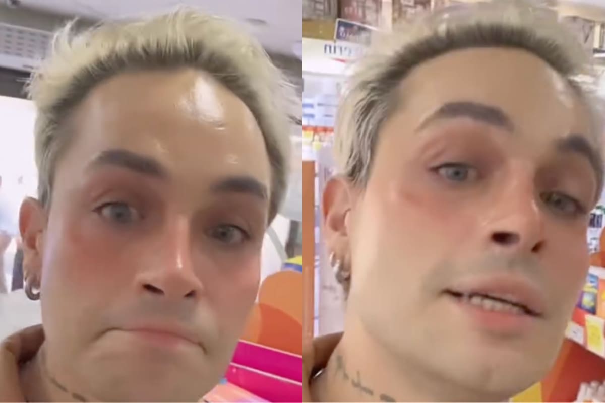 El artista sufrió brutal ataque.