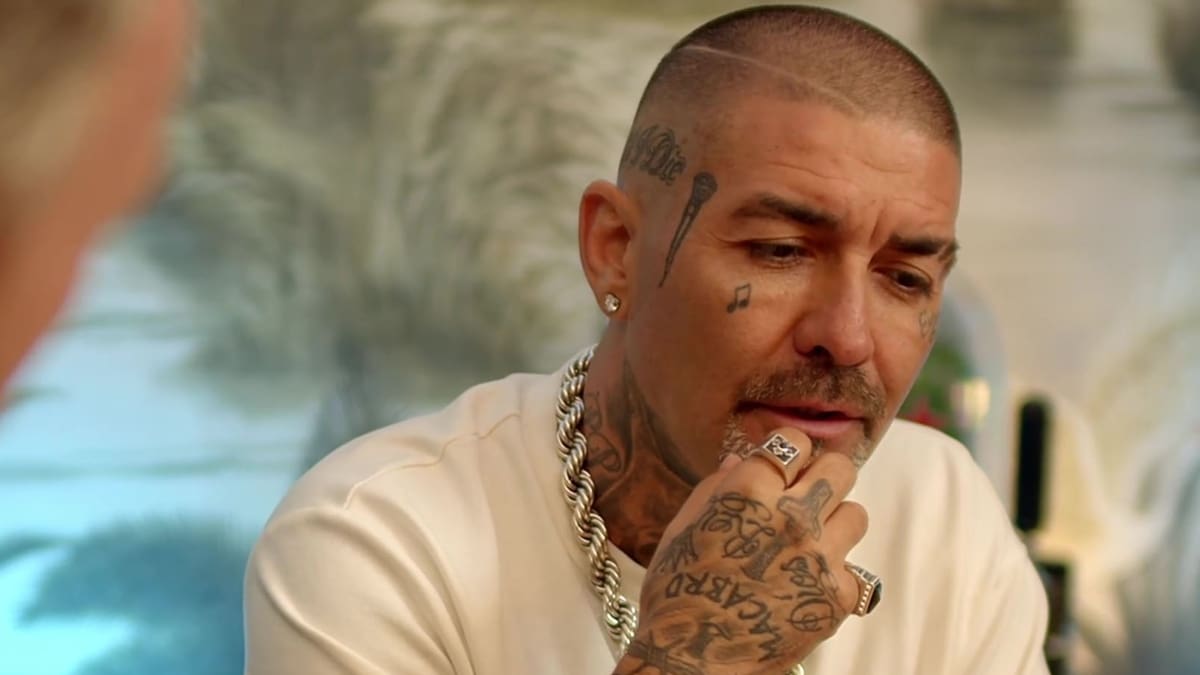 El increíble antes y después de DJ Méndez tras realizarse procedimiento estético