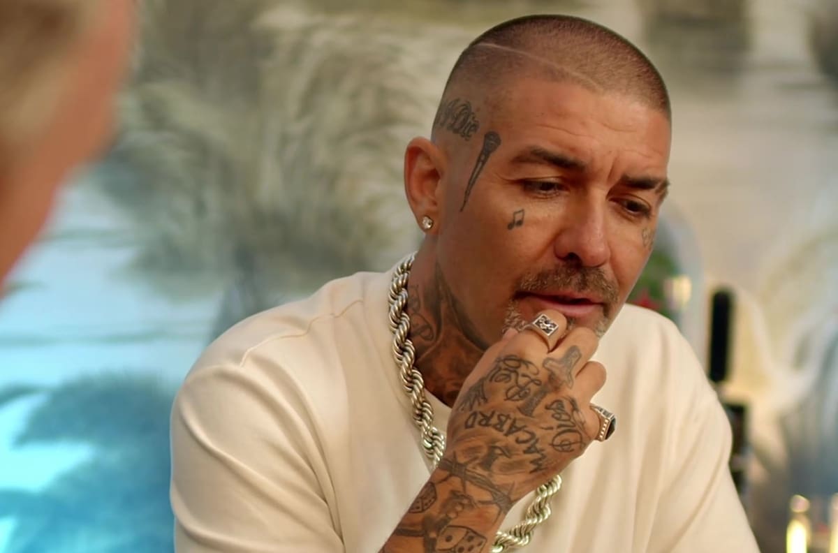 El increíble antes y después de DJ Méndez tras realizarse procedimiento estético
