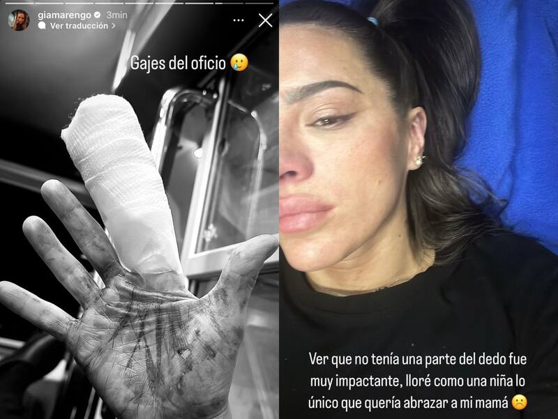 Gianella Marengo cortó su dedo y se mostró sumamente afectada. Foto: Instagram.