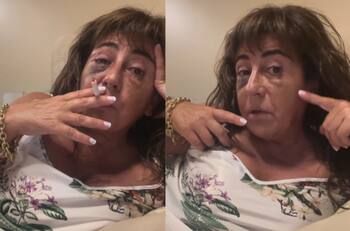 “Voy a quedar joven”: Helhue Sukni habla tras su operación estética