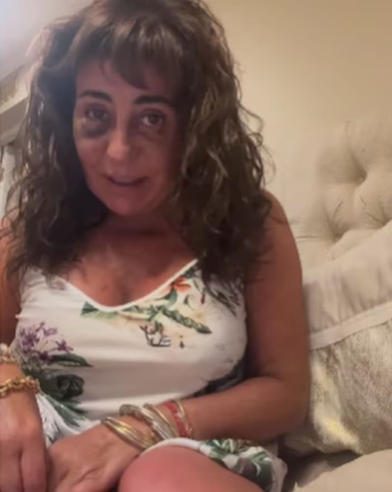 Helhu Sukni se recupera de su operación. Créditos: Instagram