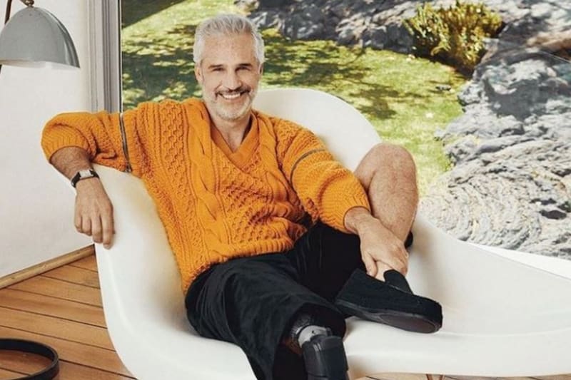 Juan Pablo Medina   El actor se mostró en público por primera vez posando con su prótesis.  - Créditos: Instagram: @juan_pablomedina