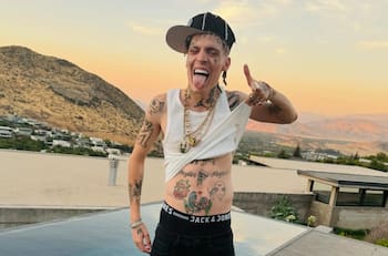 ¿Qué se sabe del estado de salud de Marcianeke tras accidente que lo dejó en la clínica?