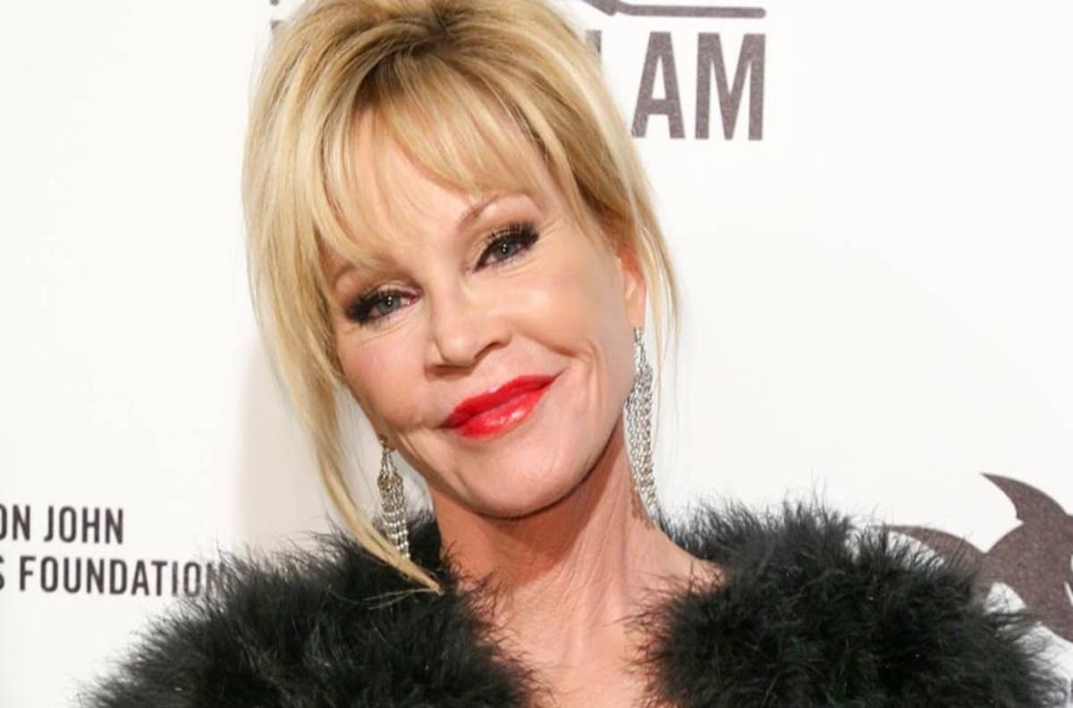 Captan a Melanie Griffith con extraños moretones en su cara y manos